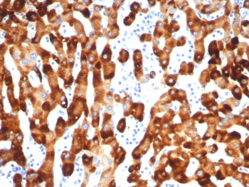 HBsAg Antibody / Hepatitis B surface antigen
