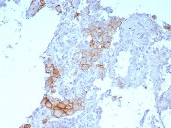 PD-L1 Antibody / B7-H1 / CD274