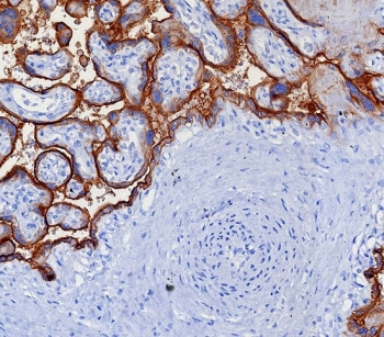 PD-L1 Antibody / B7-H1 / CD274