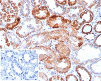 CA9 Antibody / Carbonic Anhydrase IX