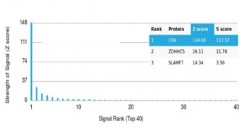 CA9 Antibody / Carbonic Anhydrase IX