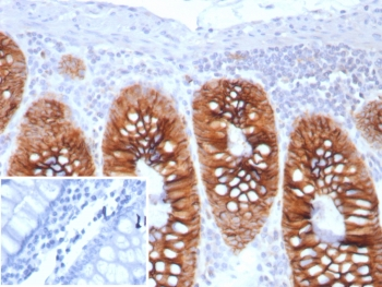 Cadherin 17 Antibody / CDH17
