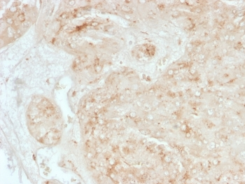 StAR Antibody / Steroidogenic acute regulatory protein