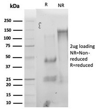 StAR Antibody / Steroidogenic acute regulatory protein