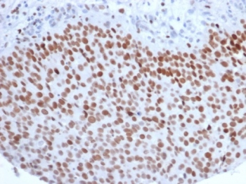 Enhancer of zeste homolog 2 Antibody / EZH2
