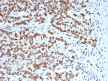 Enhancer of zeste homolog 2 Antibody / EZH2