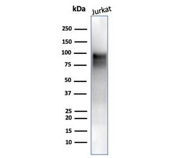 Enhancer of zeste homolog 2 Antibody / EZH2