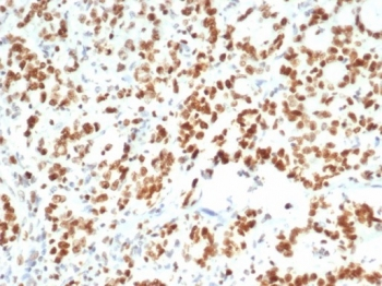 Enhancer of zeste homolog 2 Antibody / EZH2