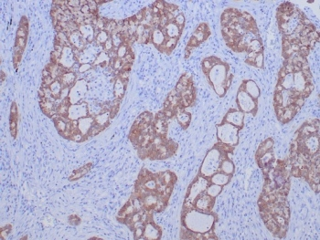 ROS1 Antibody