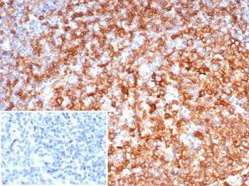 HLA-DRB Antibody