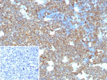 CD74 Antibody