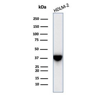STING Antibody / MITA / ERIS / TMEM17