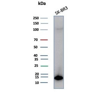 S100P Antibody