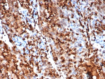 S100P Antibody