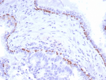 p40 / deltaNp63 Antibody