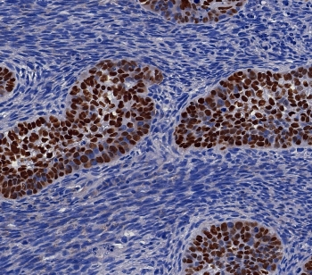 p40 / deltaNp63 Antibody