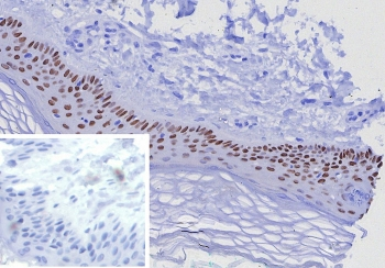 p63 Antibody / Tumor protein 63