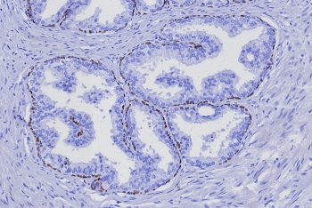 p63 Antibody / Tumor protein 63