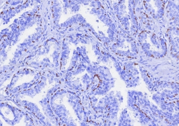 p63 Antibody / Tumor protein 63
