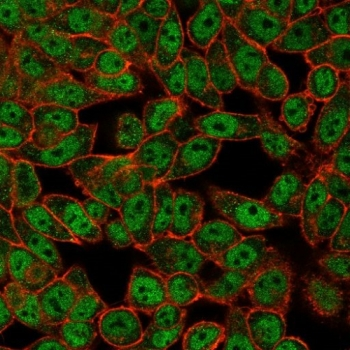 GCM2 Antibody / Glial cells missing homolog 2
