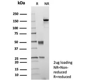 CD10 Antibody / Neprilysin