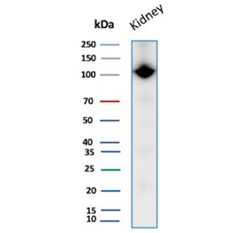 CD10 Antibody / Neprilysin