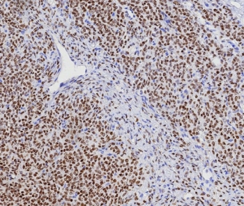 FOXL2 Antibody