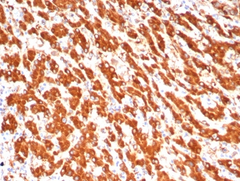 ALDH1L1 Antibody