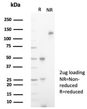 Interleukin 18 receptor alpha Antibody / IL18R1