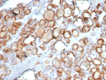 TPO Antibody / Thyroid Peroxidase