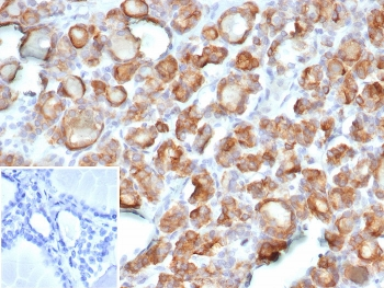 TPO Antibody / Thyroid Peroxidase