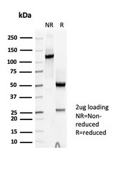 TPO Antibody / Thyroid Peroxidase