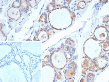 TPO Antibody / Thyroid Peroxidase