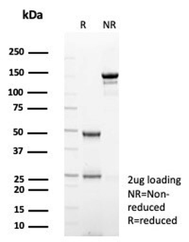 TPO Antibody / Thyroid Peroxidase
