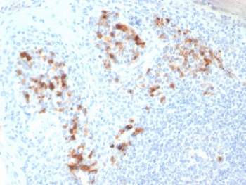 Syndecan-1 Antibody / CD138 / SDC1