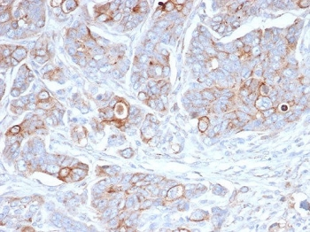 Syndecan-1 Antibody / CD138 / SDC1