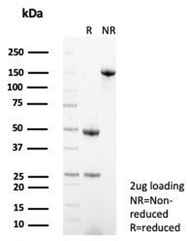Syndecan-1 Antibody / CD138 / SDC1