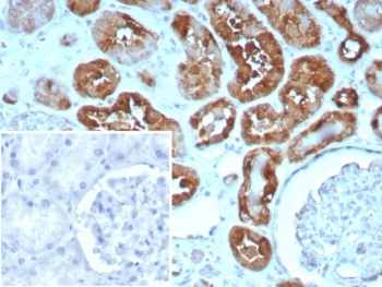FABP3 Antibody