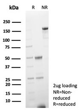 FABP3 Antibody