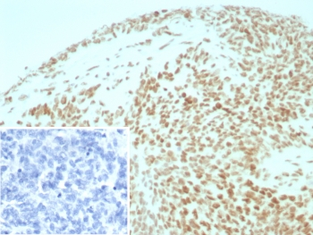 SMARCB1 Antibody / Integrase interactor 1 / BAF47