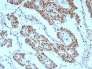 Integrase interactor 1 Antibody / INI-1 / SMARCB1 / BAF47