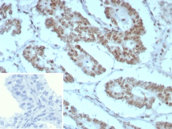 Integrase interactor 1 Antibody / INI-1 / SMARCB1 / BAF47
