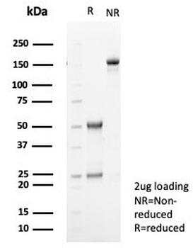 TGFB2 Antibody / TGF beta 2