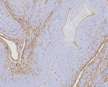CD34 Antibody