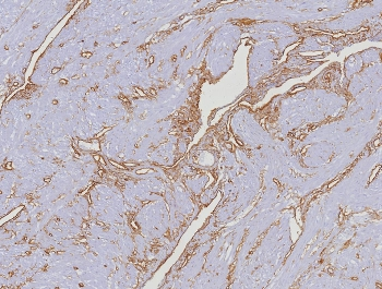 CD34 Antibody