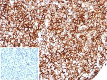 CD35 Antibody / CR1