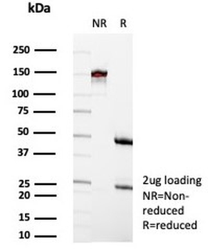 CD35 Antibody / CR1