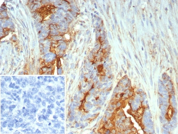 MUC1 Antibody / Mucin-1