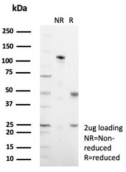 MUC1 Antibody / Mucin-1