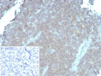 CD48 Antibody (Pan Leukocyte Marker)